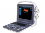 Portable Color Ultrasound system